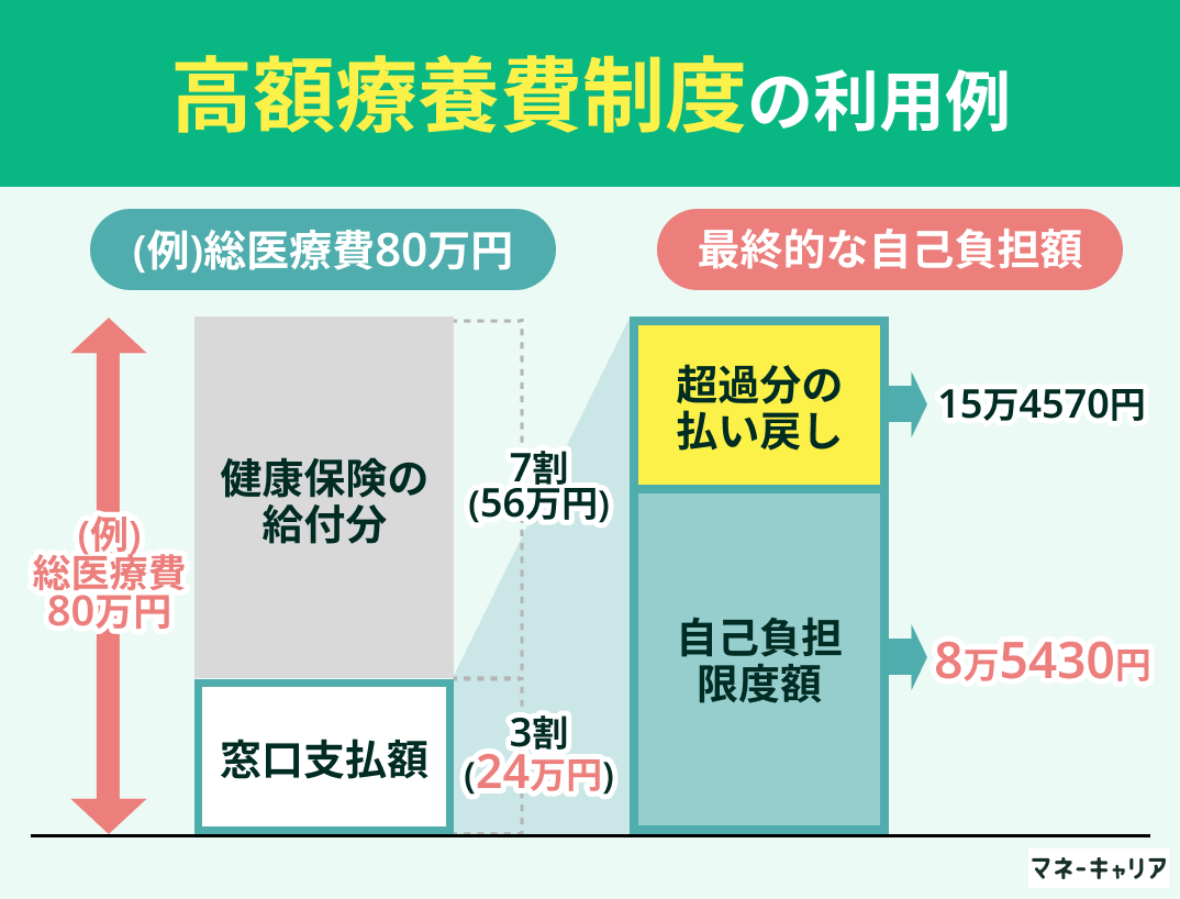 高額療養費制度の利用例